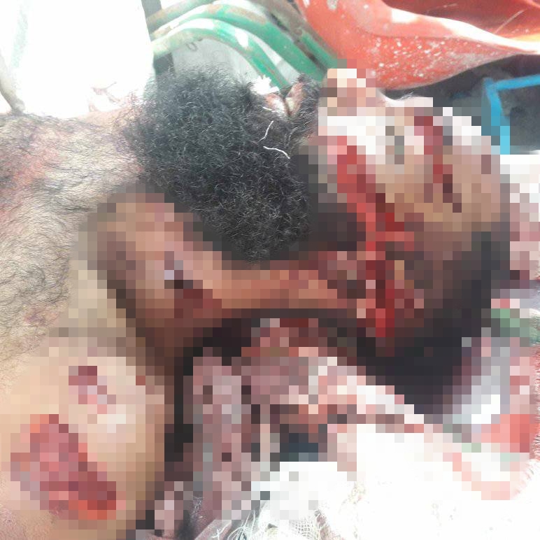 শিবপুরে কিশোর গ্যাং এর এলোপাথাড়ি কুপে একজন নি'হ'ত