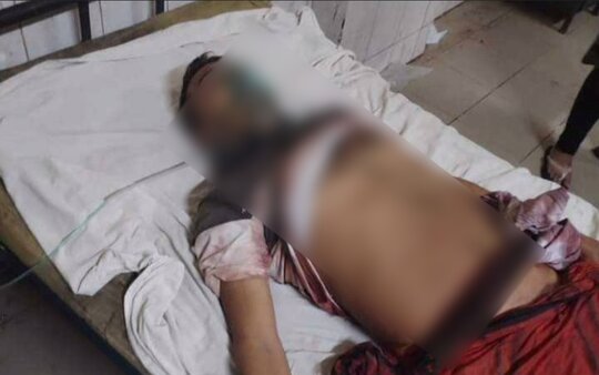 ভূঞাপুরে সন্ত্রাসীদের কোপাঘাতে এক যুবক নিহত , আহত ৬