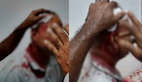 রাজধানীর উত্তরায় ছাত্রদল নেতাকে কুপিয়ে জখম