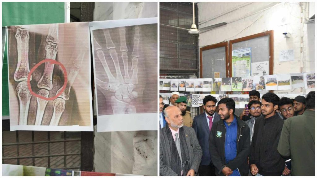 বাকৃবির আবাসিক হলে 'টর্চার কর্নার': ছাত্রলীগের নির্যাতনের চিত্র তুলে ধরল শিক্ষার্থীরা
