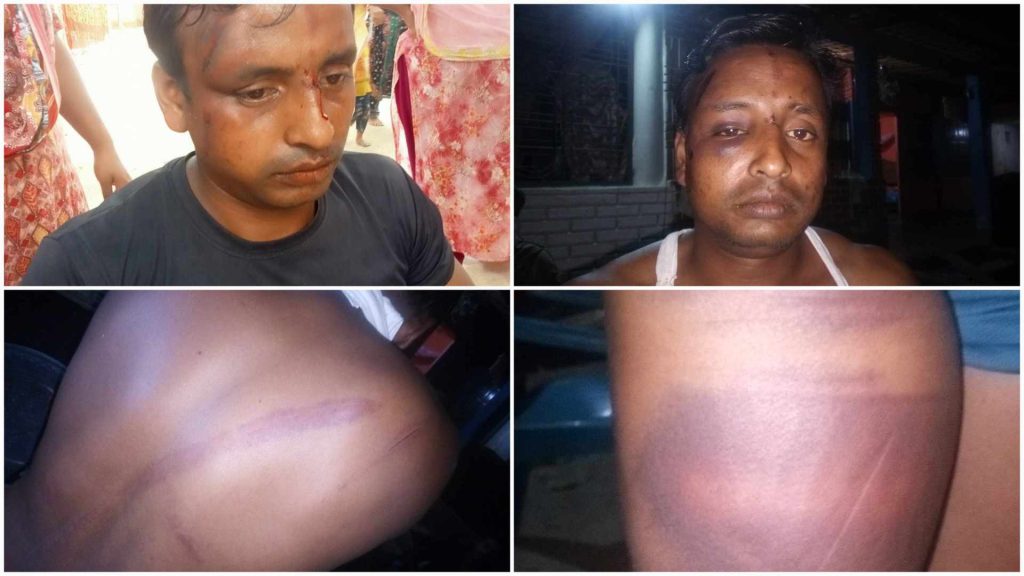শ্বশুর এবং শ্যালকের মারপিঠে আহত জামাই, থানায় অভিযোগ