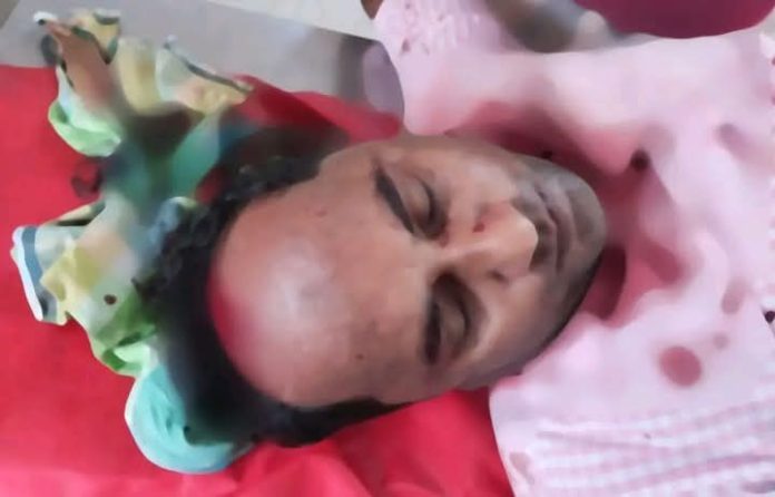 গ্রুপে সংঘর্ষ, গুলিবিদ্ধ বিএনপি নেতা