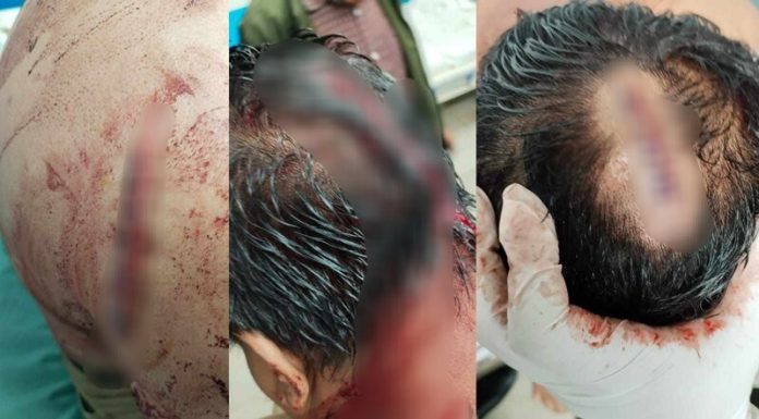 মিরপুরে সন্ত্রাসী কর্মকাণ্ডের নেপথ্যে শাহীন শিকদার, ভয়ে মুখ খোলে না কেউ