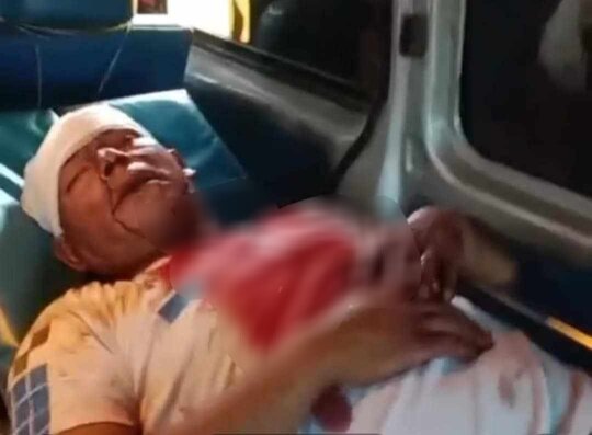 জমি সংক্রান্ত বিরোধের জেরে রূপগঞ্জে যুবদল নেতার হামলায় শিক্ষকসহ আহত ৩